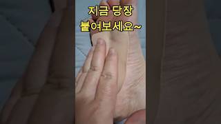 지금 당장 붙여보세요#파스#건강 #건강정보 #힐링 #cat #고양이