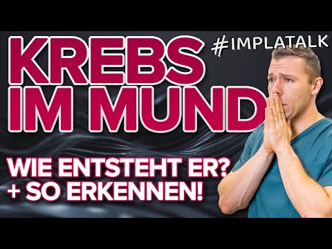 Video: Anzeichen von Mundkrebs erkennen – wikiHow