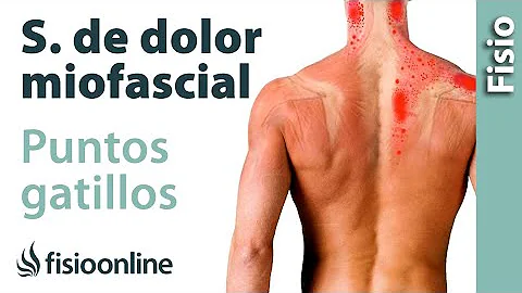 ¿Qué ocurre si no se trata el síndrome de dolor miofascial?