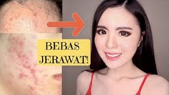 10 CARA YANG HARUS DILAKUKAN UNTUK MENGHILANGKAN JERAWAT (PENGALAMAN SENDIRI) - Durasi: 13.58. 10 CARA YANG HARUS DILAKUKAN UNTUK MENGHILANGKAN JERAWAT (PENGALAMAN SENDIRI) - Durasi: 13.58.