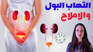 اعراض التهاب البول والاملاح