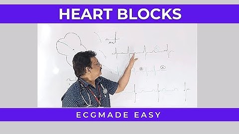 ECG GEMAKKELIJK GEMAAKT || HARTBLOKKEN