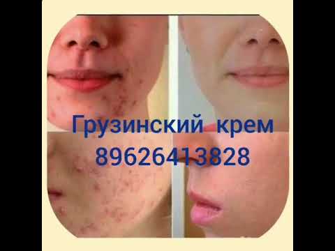 Что такое псориаз и как он опасен для здоровья