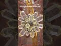 A STONE INSIDE YOU?!-3D MEDICAL ANIMATION