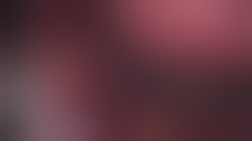 laparoscopic cholecystectomy hook disecction