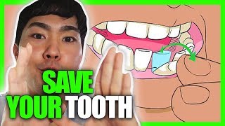 How To Prevent Tooth Loss