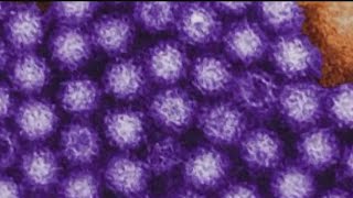 Norovirus cases are on the rise in Connecticut