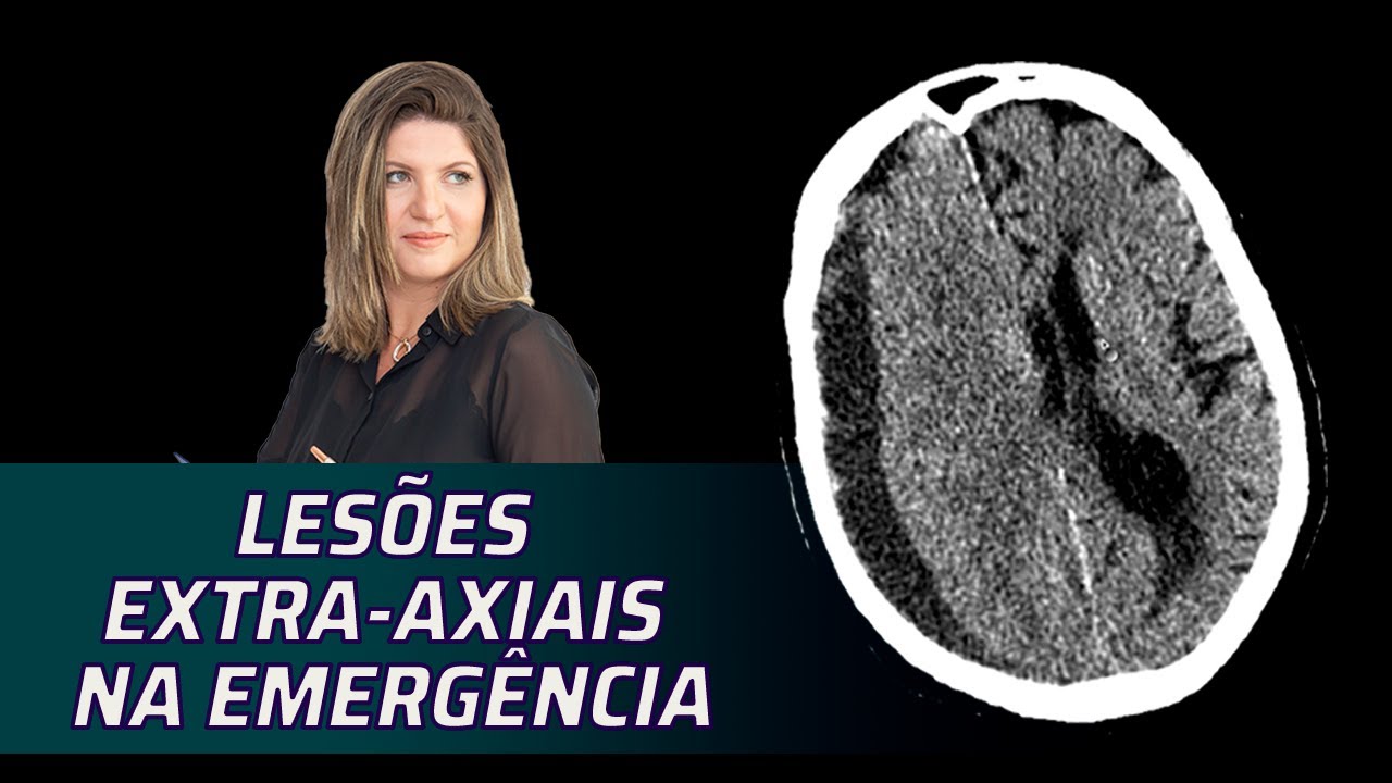 VALORIZANDO O ESPAÇO EXTRA-AXIAL NA EMERGÊNCIA - YouTube