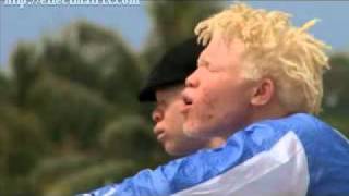 Les frères albinos-Wontanara.mpg