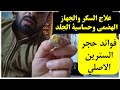 فوائد حجر السترين الأصلي حجر المال والثروة وعلاج السكر والجهاز الهضمي وحساسية الجلد