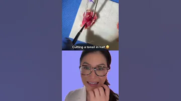 Cutting Open A Tonsil To See All The Baby Tonsil Stones Don T Watch If Dissection Makes You Sick 