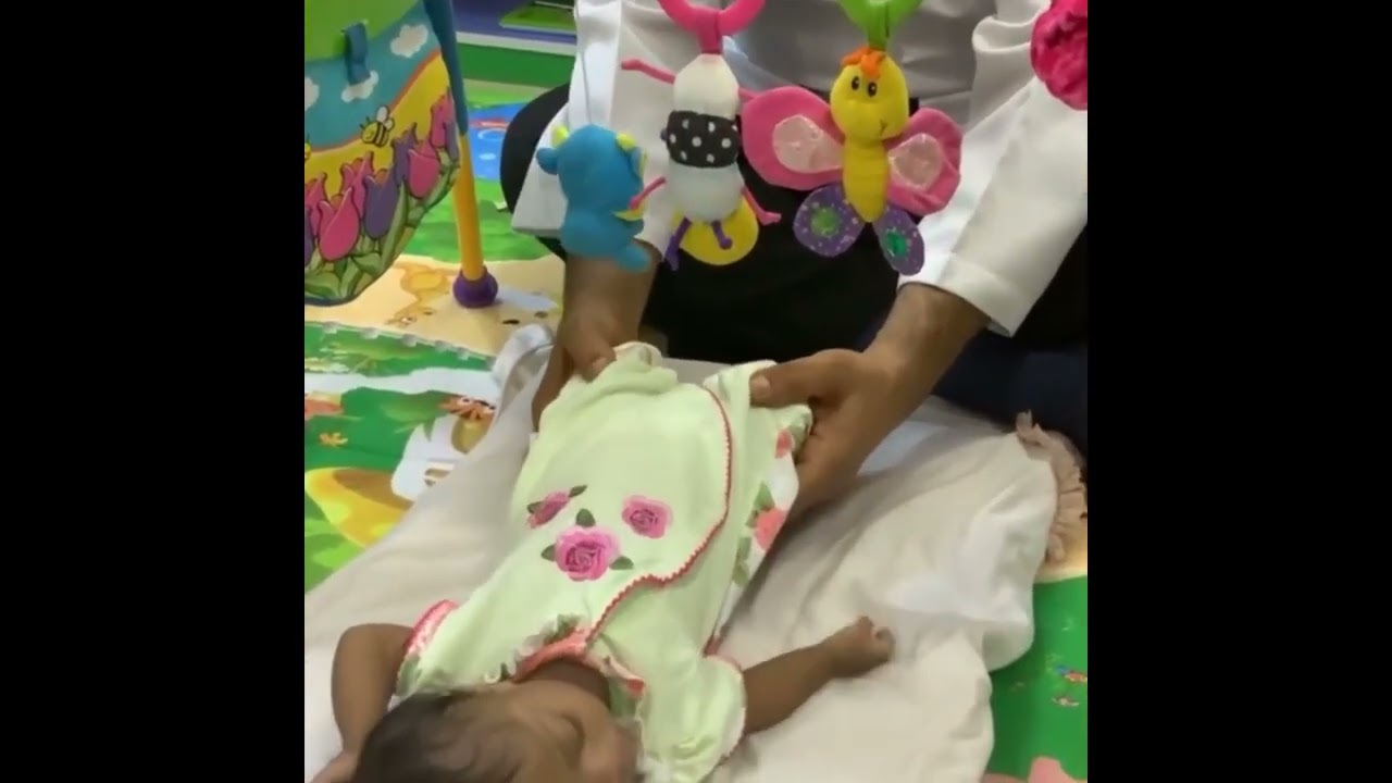 التدريبات الذهبية لتقوية عضلات القدم حتى تستيطع المشي في وقته لطفلة متلازمة داون مع اسامة مدبولي