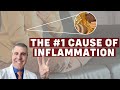 Essentials of inflammation ep 3 the most common trigger of inflammation
