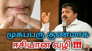 முகப்பரு நீங்க இயற்கை வழி | Pimples,Acne,Dark spot removal treatment by Dr.Sivaraman