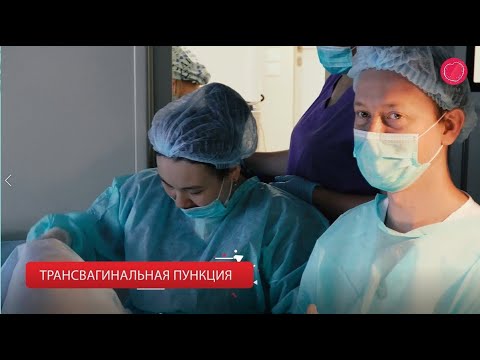 Пункция фолликулов. Оплодотворение и перенос эмбриона в полость матки