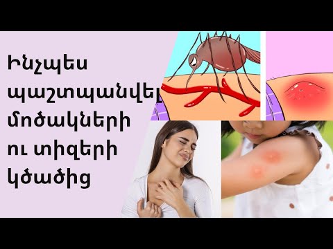 Video: Տիզերը կսպանե՞ն: