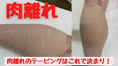 ふくらはぎの肉離れを救ってくれた最強アイテム バンテリンサポーター とここに行けば必ず治る野球専門整骨院 Youtube