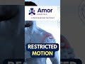 Frozen Shoulder | Shoulder | Orthopedic | Amor Hospital