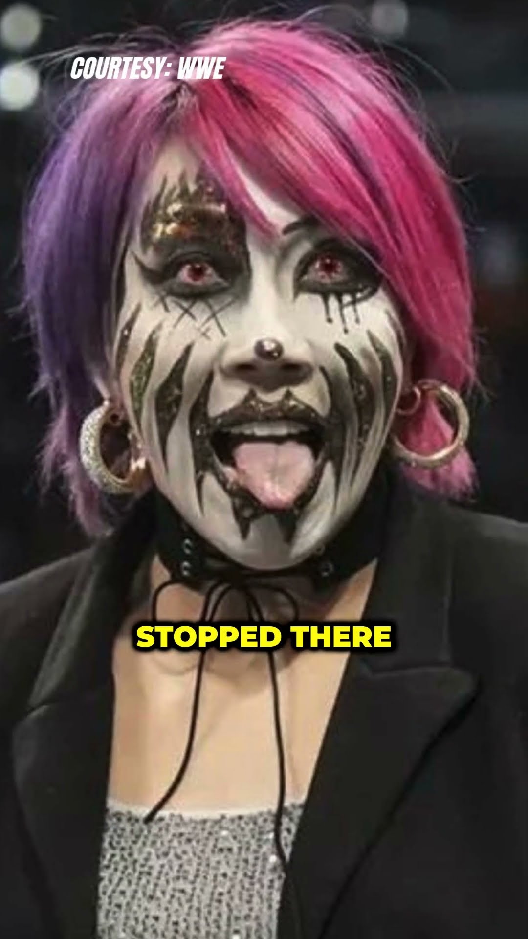 Asuka’s Tough News! Nine Months Post-Surgery and Still Fighting! #Asuka #WWE #InjuryUpdate #shorts