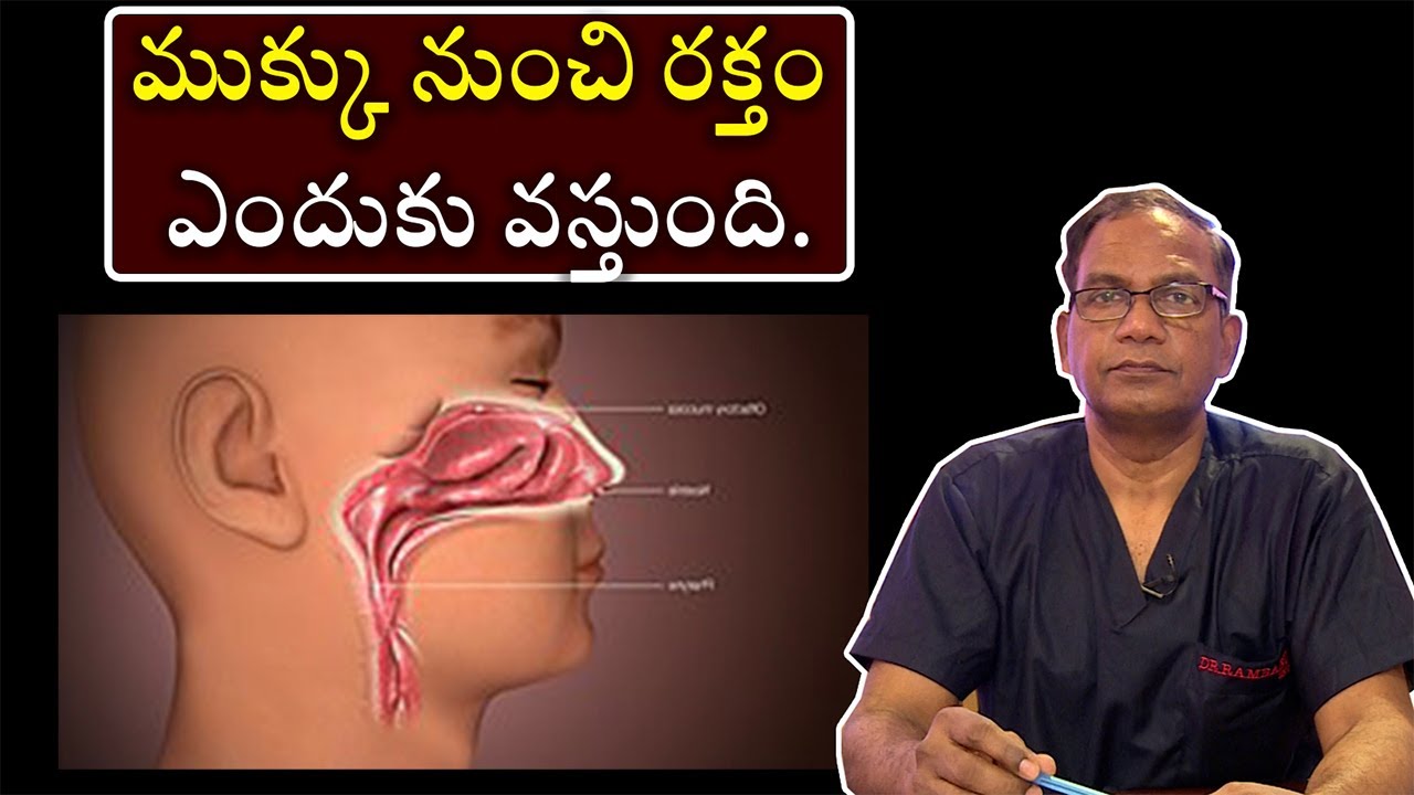 Bleeding From Nose ముక్కు నుంచి రక్తం ఎందుకు వస్తుంది YouTube