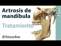 Artrosis de mandíbula - Qué es, causas, síntomas y tratamiento
