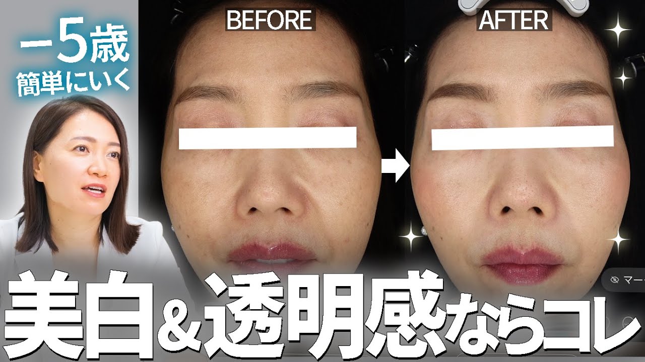 【実例紹介】角質ケアでー5歳、リアルにいった人たち