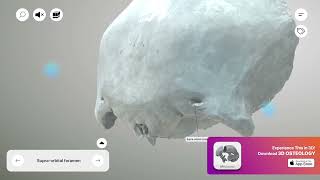 Frontal Bone - Supraorbital Foramen