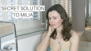 A Dermatologists Secret To Solving Milia