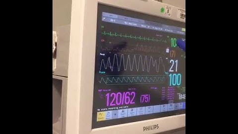How to Zero an EVD & Measure ICP with Neurosurgeon & Nurse Xtina