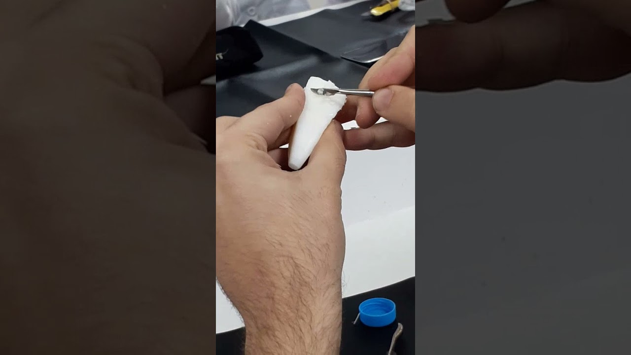 تشريح اسنان نحت الثنية العلوية