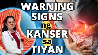 Warning Signs ng Kanser sa Tiyan - By Doc Liza Ramoso-Ong