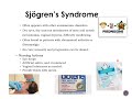 Sjgrens syndrome