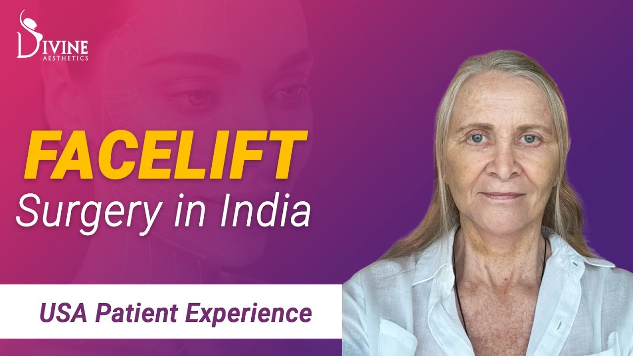 USA Patient Experience Facelift Surgery in India Sagging Face