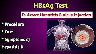 HBsAg Test Procedure for Hepatitis B Virus infection