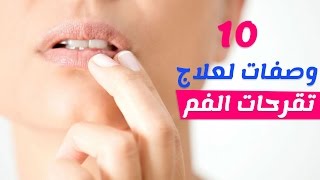 10 وصفات طبيعية لعلاج تقرحات الفم واللسان