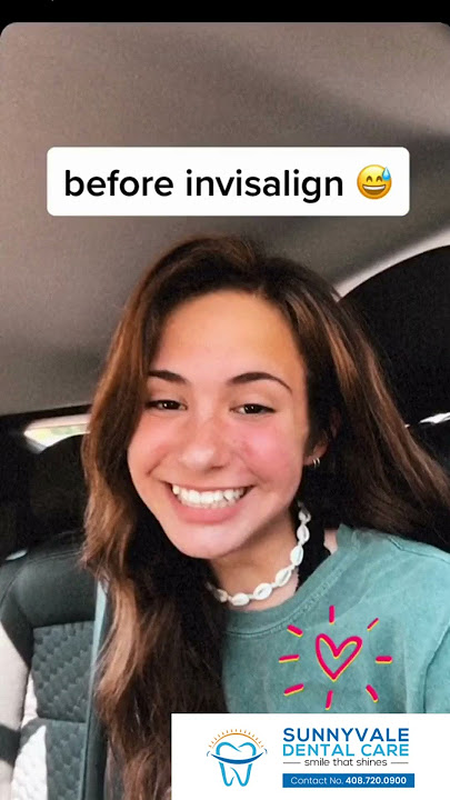 Before and After Invisalign