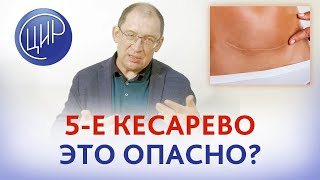 5-е кесарево - опасно или нет? Как подготовиться к пятому кесареву сечению за время беременности.