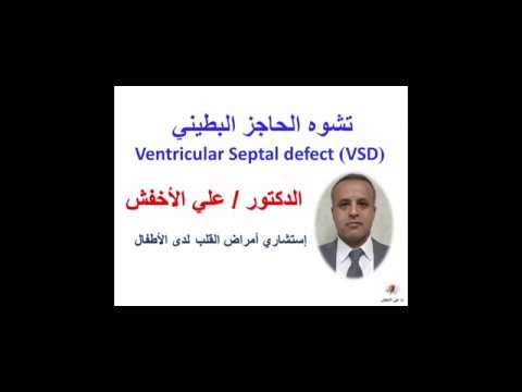 د/علي الاخفش يتكلم عن ثقب الحاجز البطيني Ventricular Septal defect (VSD)