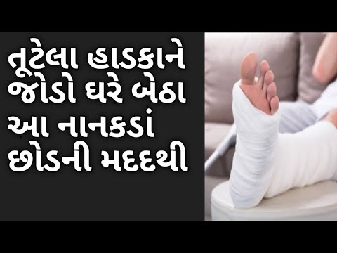 હાથ પગના તૂટેલા હાડકાને જોડો ઘેર બેઠા આ ઘરગથ્થુ ઉપચારથી/Frecture treatment/leg and hand crack