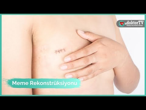 Meme Rekonstrüksiyonu | Meme Kanseri Sonrası | Özdoku ile Meme Onarımı