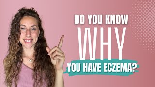 The Root Cause of My Eczema (And How You Can Fix Yours)