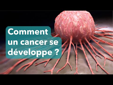Vidéo: Où se produisent les carcinomes ?
