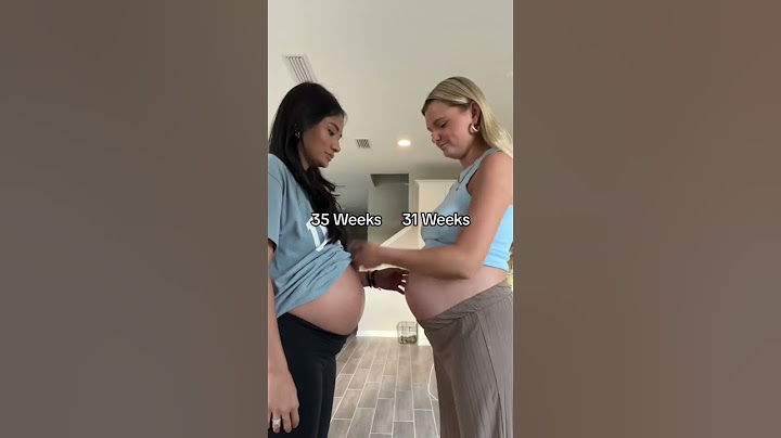 YOUR BESTIE IS PREGNANT AT THE SAME TIME AS YOU #shorts