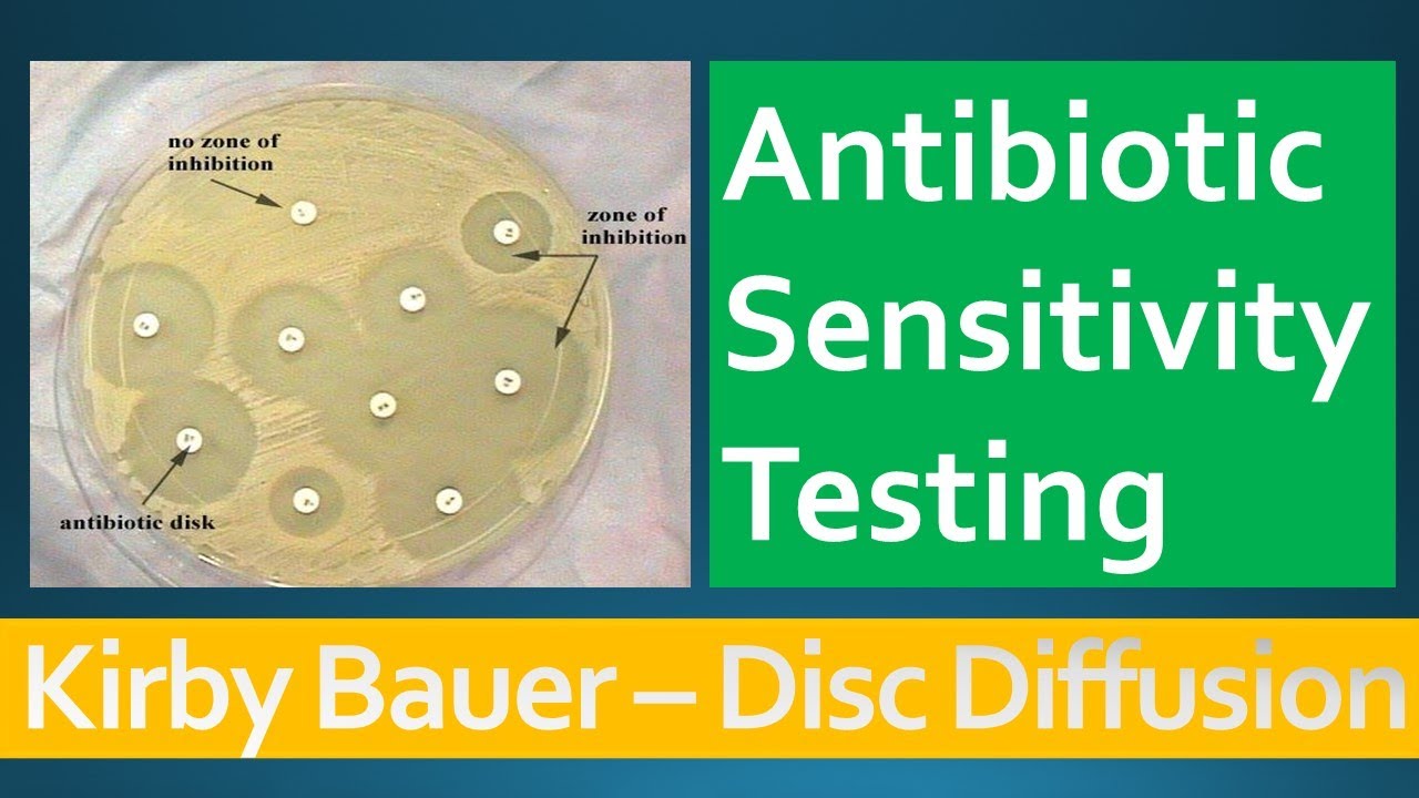 Kirby Bauer - Disc Diffusion Method for Antibiotic Susceptibility Testing -  YouTube