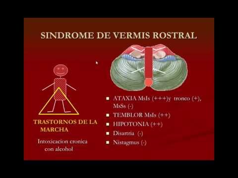 Vídeo: Hechos, Función, Ubicación Y Trastornos Del Cerebelo