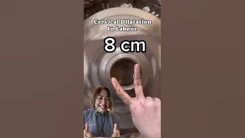 Doctor Explains full cervical Dilatation# pregnancy #labour