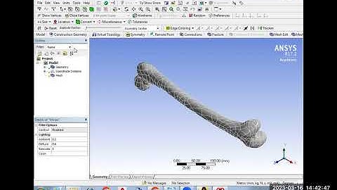 Session-12: Biomechanical Analysis of Femur Bone using ANSYS Workbench