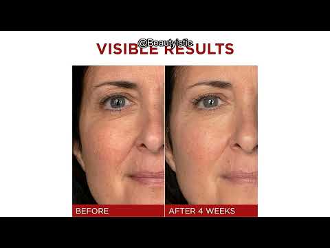 L'Oreal Revitalift Triple Power Review: Worth the Money or Overrated?