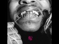 Injury Reserve - S On Ya Chest