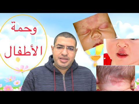 فيديو: كيفية قطع يوركي وجه طفل